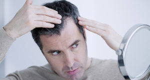 Homem preocupado com o cabelo