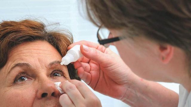 Glaucoma Glaucoma