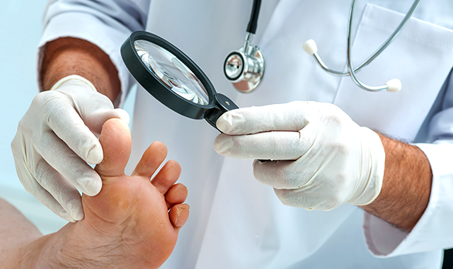 Tratamento de micoses de unhas e cutículas Tratamento-de-micoses-de-unhas-e-cuticulas