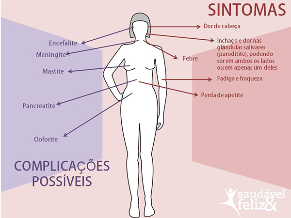 Sintomas e complicações da caxumba sintomas-e-complicacoes-da-caxumba