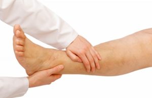 Varizes e vasinhos: por que aparecem? Qual a diferença entre eles? varizes-e-vasinhos