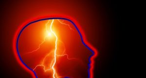 epilepsia