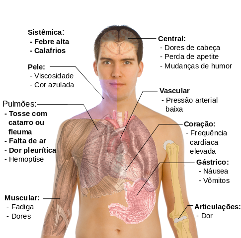 pneumonia-como-tratar