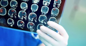 neurologista