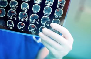 neurologista