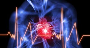 angina