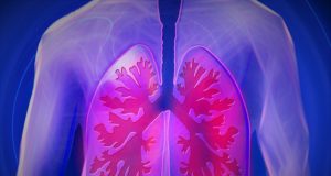 cancer-de-pulmao