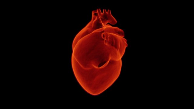 infarto-fulminante