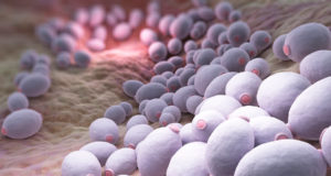 candidiase