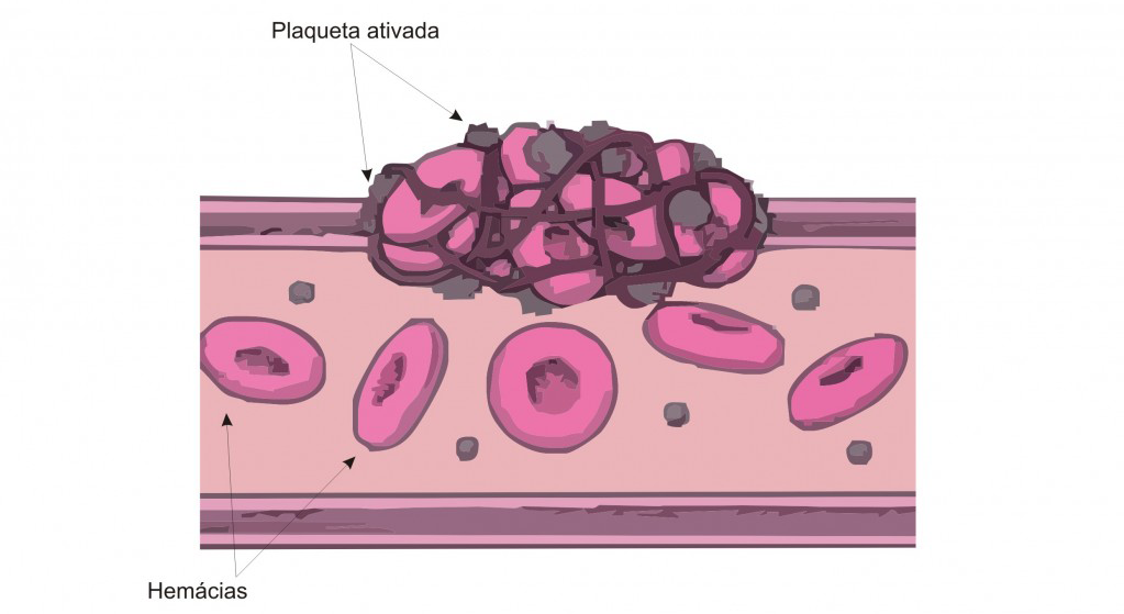 doenças no sangue mais comuns doenças-no-sangue-mais-comuns