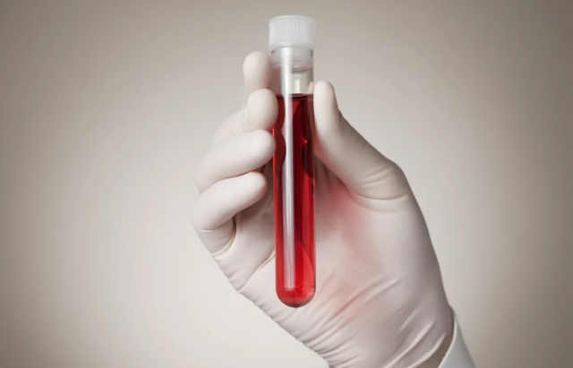 doenças no sangue mais comuns doenças-no-sangue-mais-comuns