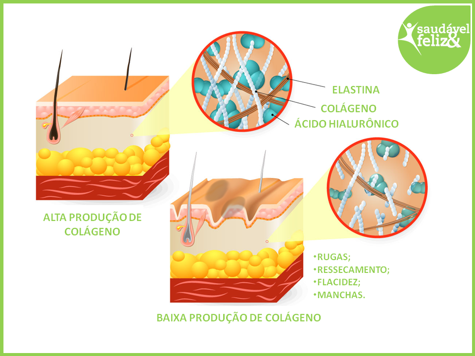 Menopausa e a perda de colágeno menopausa-e-a-perda-de-colageno