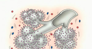 tipos-de-fibrose