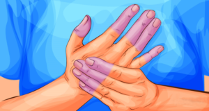 sindrome-de-raynaud