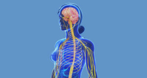 neuralgia